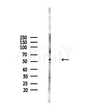 CHRNA5 Antibody - Western blot analysis of lysates from A375 cells(starvation,24h treatment), using CHRNA5 Antibody at 1/1000 dilution.
