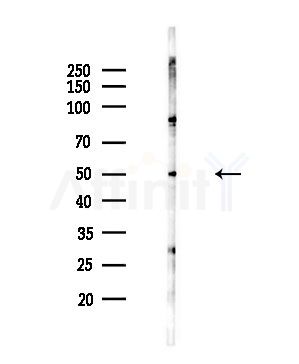 CHRNA5 Antibody - Western blot analysis of lysates from HepG2 cells(LPS,4h treatment), using CHRNA5 Antibody at 1/1000 dilution.