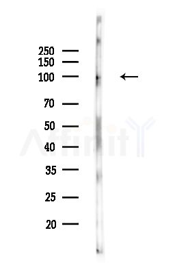 DNA Ligase IV Antibody - Western blot analysis of lysates from PC12 cells(UV,30min treatment), using DNA Ligase IV Antibody at 1/1000 dilution.