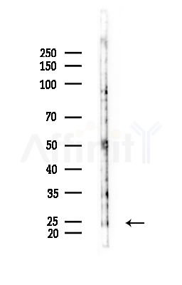 FXN Antibody - Western blot analysis of lysates from Mouse testis, using FXN Antibody at 1/1000 dilution.