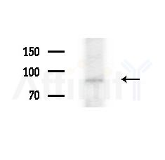 MTTP Antibody - Western blot analysis of extracts from HepG2 cells(LPS, 4h treatment), using MTTP Antibody at 1/1000 dilution.