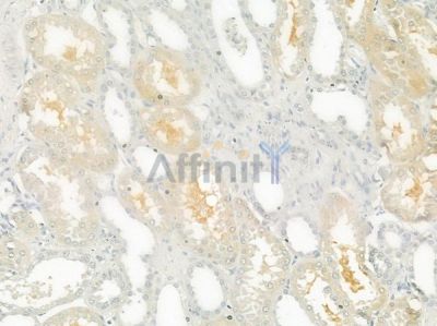 MTTP Antibody - DF6591 at 1/100 staining human normal kidney tissue by IHC-P.
