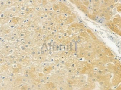 MTTP Antibody - DF6591 at 1/100 staining human normal liver tissue by IHC-P.