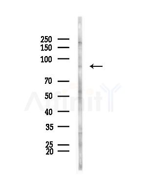 MTTP Antibody - Western blot analysis of lysates from HepG2 cells(LPS, 4h treatment), using MTTP Antibody at 1/1000 dilution.