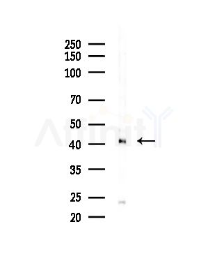 FCER1A Antibody - Western blot analysis of lysates from Hela cells(LPS,4h treatment), using FCER1A Antibody at 1/1000 dilution.