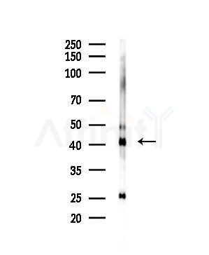 FCER1A Antibody - Western blot analysis of lysates from Rat liver, using FCER1A Antibody at 1/1000 dilution.