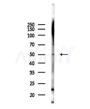 FCER1A Antibody - Western blot analysis of lysates from Mouse lung, using FCER1A Antibody at 1/1000 dilution.