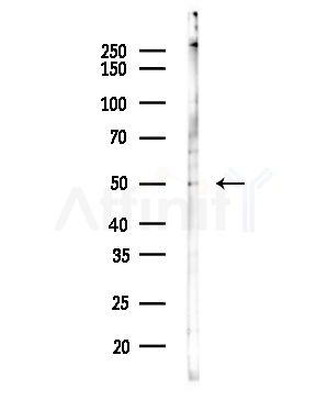 FCER1A Antibody - Western blot analysis of lysates from COLO205 cells(heat-shock,45min treatment), using FCER1A Antibody at 1/1000 dilution.