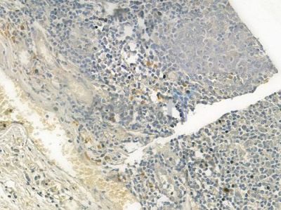 CD1D Antibody - DF6597 at 1/100 staining human normal tonsil tissue by IHC-P.