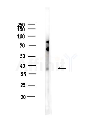 CD1D Antibody - Western blot analysis of lysates from A375 cells(heat-shock,45min treatment), using CD1D Antibody at 1/1000 dilution.