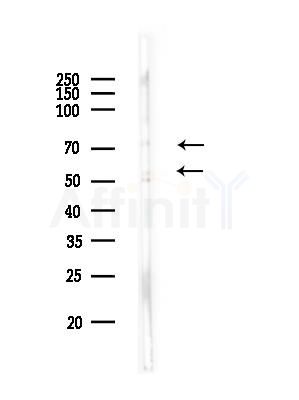 IFNAR2 Antibody - Western blot analysis of lysates from Mouse testis, using IFNAR2 Antibody at 1/1000 dilution.