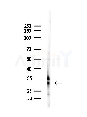 Cyclin D2 Antibody - Western blot analysis of lysates from PC12 cells(starvation,24h treatment), using Cyclin D2 Antibody at 1/1000 dilution.