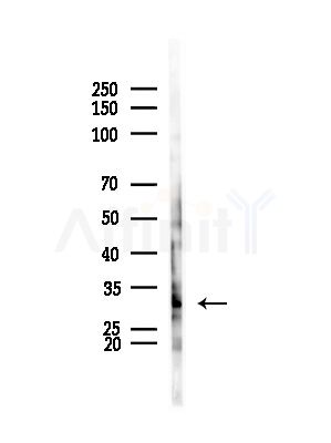 Cyclin D2 Antibody - Western blot analysis of lysates from HepG2 cells(LPS, 4h treatment), using Cyclin D2 Antibody at 1/1000 dilution.
