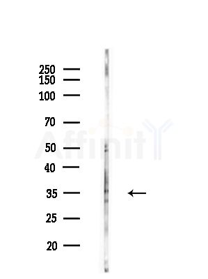 HMBS Antibody - Western blot analysis of lysates from HUVEC cells(starvation,24h treatment), using HMBS Antibody at 1/1000 dilution.
