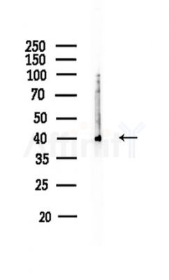 CTSK Antibody - Western blot analysis of lysates from HUVEC cells, using CTSK Antibody at 1/1000 dilution.