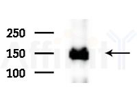 DCTN1 Antibody - Western blot analysis of lysates from HepG2 cells(starvation treatment), using DCTN1 Antibody at 1/1000 dilution.