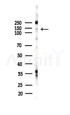 DCTN1 Antibody - Western blot analysis of lysates from HepG2 cells(starvation,24h treatment), using DCTN1 Antibody at 1/1000 dilution.