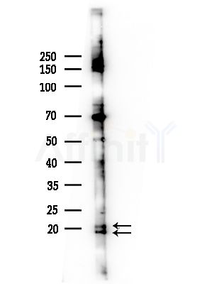 VIP Antibody - Western blot analysis of lysates from COLO205 cells(heat-shock,45min treatment), using VIP Antibody at 1/1000 dilution.