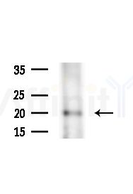 ICOS Antibody - Western blot analysis of extracts from Rat liver, using ICOS Antibody at 1/1000 dilution.