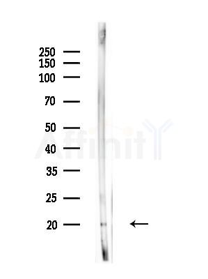 ICOS Antibody - Western blot analysis of lysates from Rat liver, using ICOS Antibody at 1/1000 dilution.
