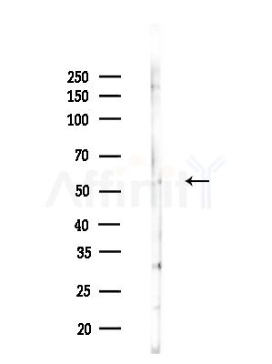 SLC22A6 Antibody - Western blot analysis of lysates from B16F10-LUC cells(LPS,4h treatment), using SLC22A6 Antibody at 1/1000 dilution.