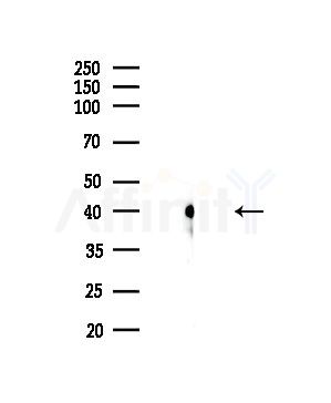 IL2RG Antibody - Western blot analysis of lysates from COLO205 cells, using IL2RG Antibody at 1/1000 dilution.