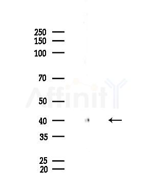 IL2RG Antibody - Western blot analysis of lysates from EC304 cells, using IL2RG Antibody at 1/1000 dilution.