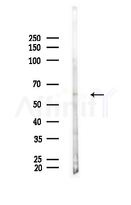IL-10R alpha Antibody - Western blot analysis of lysates from Mouse testis, using IL-10R alpha Antibody at 1/1000 dilution.