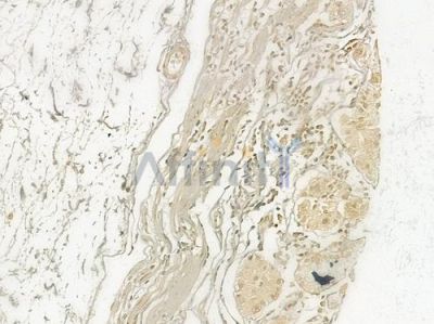 RBX1 Antibody - DF6645 at 1/100 staining human normal gastric tissue by IHC-P.