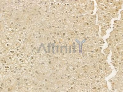 RBX1 Antibody - DF6645 at 1/100 staining human normal liver tissue by IHC-P.