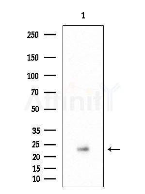 SP-C Antibody - Western blot analysis of extracts from Rat lung, using SP-C Antibody at 1/1000 dilution.