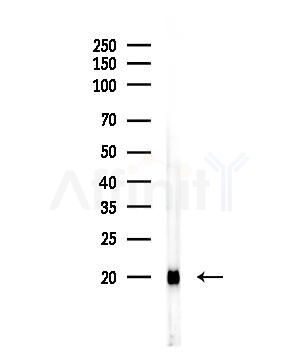 SP-C Antibody - Western blot analysis of lysates from Rat lung, using SP-C Antibody at 1/1000 dilution.