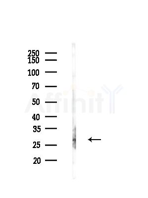 NR0B2 Antibody - Western blot analysis of lysates from COLO205 cells(heat-shock,45min treatment), using NR0B2 Antibody at 1/1000 dilution.
