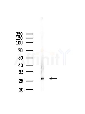 NR0B2 Antibody - Western blot analysis of lysates from Rat liver, using NR0B2 Antibody at 1/1000 dilution.