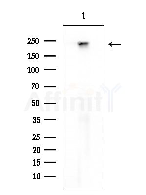 HCFC1 Antibody - Western blot analysis of extracts from HUVEC cells, using HCFC1 Antibody at 1/1000 dilution.