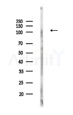 RPGR Antibody - Western blot analysis of lysates from PC12 cells(UV,30min treatment), using RPGR Antibody at 1/1000 dilution.