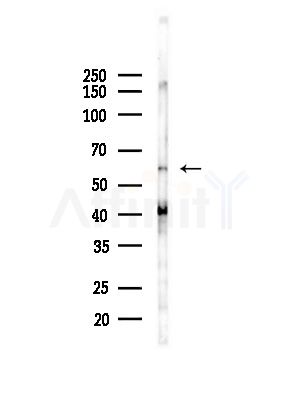 HSPA1L Antibody - Western blot analysis of lysates from Hela cells(heat-shock,45min treatment), using HSPA1L Antibody at 1/1000 dilution.