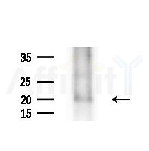 POLR2D Antibody - Western blot analysis of lysates from PC12 cells(starvation,24h treatment), using POLR2D Antibody at 1/1000 dilution.