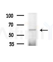 DKC1 Antibody - Western blot analysis of extracts from B16F10-LUC cells(UV,30min treatment), using DKC1 Antibody at 1/1000 dilution.