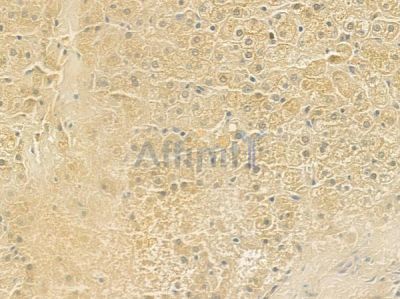 DKC1 Antibody - DF6666 at 1/100 staining human normal liver tissue by IHC-P.