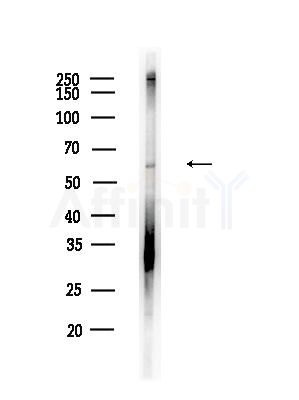 DKC1 Antibody - Western blot analysis of lysates from B16F10-LUC cells(UV,30min treatment), using DKC1 Antibody at 1/1000 dilution.