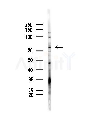 GLB1 Antibody - Western blot analysis of lysates from HepG2 cells(LPS, 4h treatment), using GLB1 Antibody at 1/1000 dilution.