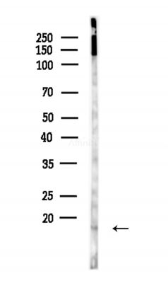 POLR2I Antibody - Western blot analysis of lysates from Hela cells(heat-shock,45min treatment), using POLR2I Antibody at 1/1000 dilution.