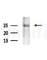 LY96 Antibody - Western blot analysis of lysates from various samples, using LY96 Antibody at 1/1000 dilution.