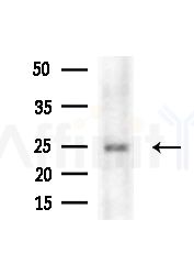 LY96 Antibody - Western blot analysis of lysates from 293 cells(UV treatment), using LY96 Antibody at 1/1000 dilution.