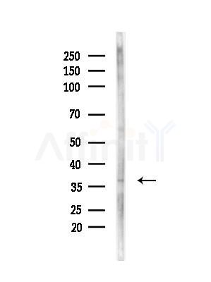 RAD9 Antibody - Western blot analysis of lysates from 293 cells(UV treatment), using RAD9 Antibody at 1/1000 dilution.