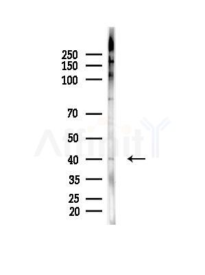 RAD9 Antibody - Western blot analysis of lysates from Hela cells(LPS,4h treatment), using RAD9 Antibody at 1/1000 dilution.