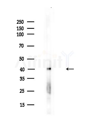 PDHA1 Antibody - Western blot analysis of lysates from A375 cells(heat-shock,45min treatment), using PDHA1 Antibody at 1/1000 dilution.