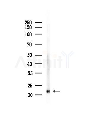 Peroxiredoxin 2 Antibody - Western blot analysis of lysates from Hela cells(heat-shock,45min treatment), using Peroxiredoxin 2 Antibody at 1/1000 dilution.