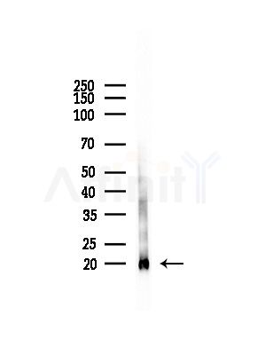 Peroxiredoxin 2 Antibody - Western blot analysis of lysates from Rat brain, using Peroxiredoxin 2 Antibody at 1/1000 dilution.